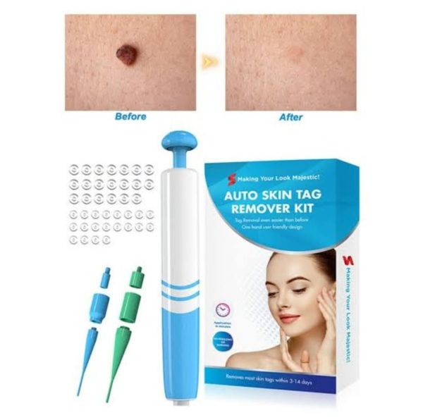Auto Skin Tag Remover Painless | Skin Tag Removal Kit Adult Mole Wart Remover