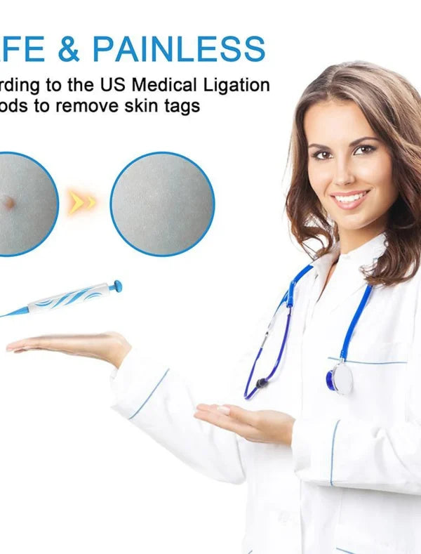 Auto Skin Tag Remover Painless | Skin Tag Removal Kit Adult Mole Wart Remover