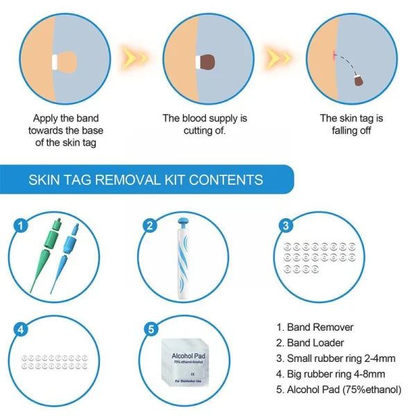 Auto Skin Tag Remover Painless | Skin Tag Removal Kit Adult Mole Wart Remover