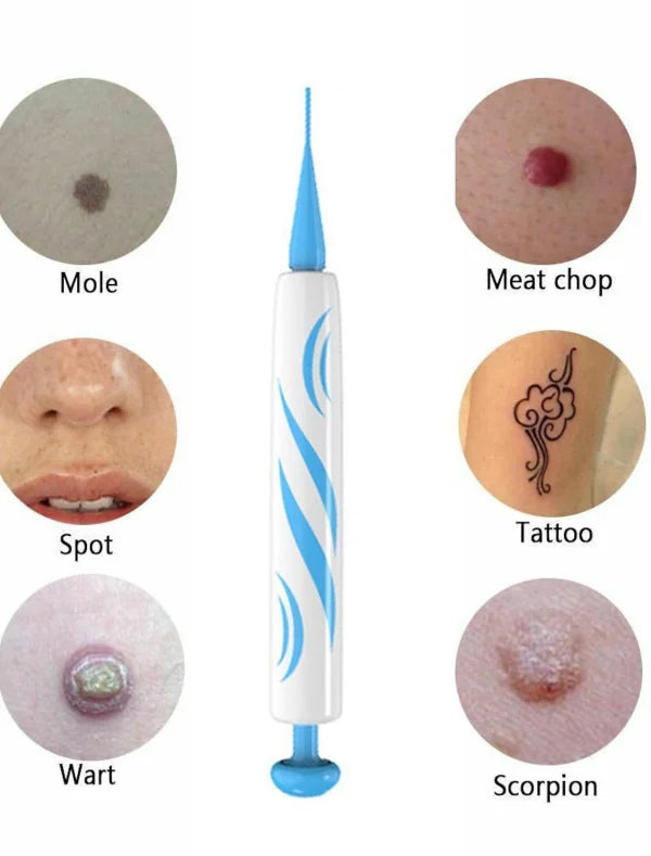 Auto Skin Tag Remover Painless | Skin Tag Removal Kit Adult Mole Wart Remover