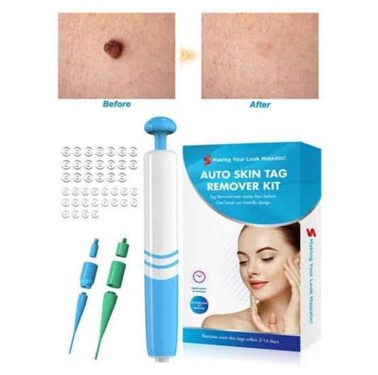 Auto Skin Tag Remover Painless | Skin Tag Removal Kit Adult Mole Wart Remover